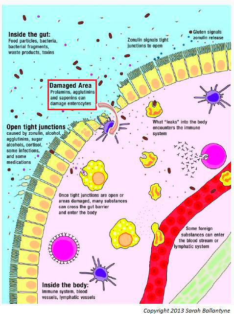 Intestino permeável
