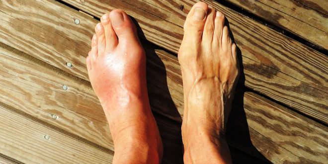 Gota e unha do diabo Gota e unha do diabo