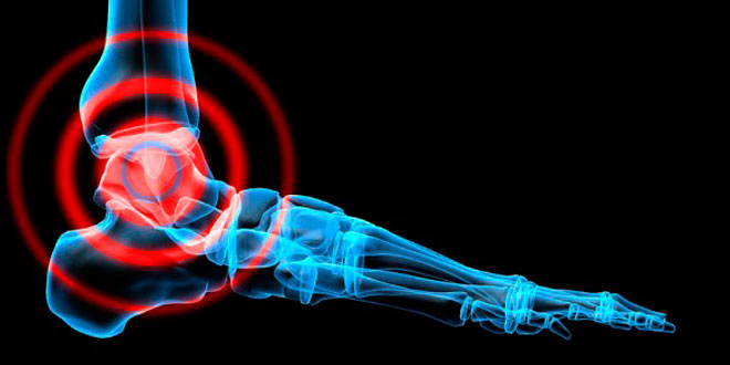 Exercícios para fortalecer o tornozelo Exercícios para fortalecer o tornozelo