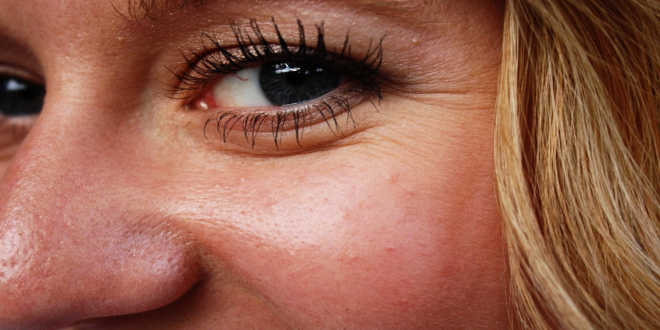 isoflavonas de soja acido hialuronico