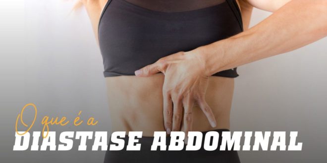 Diástase Abdominal: O que é, Como Prevenir e Falsos Mitos