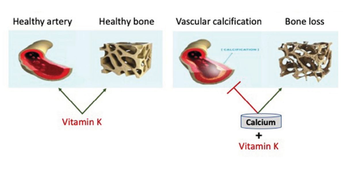 Saúde óssea e vascular