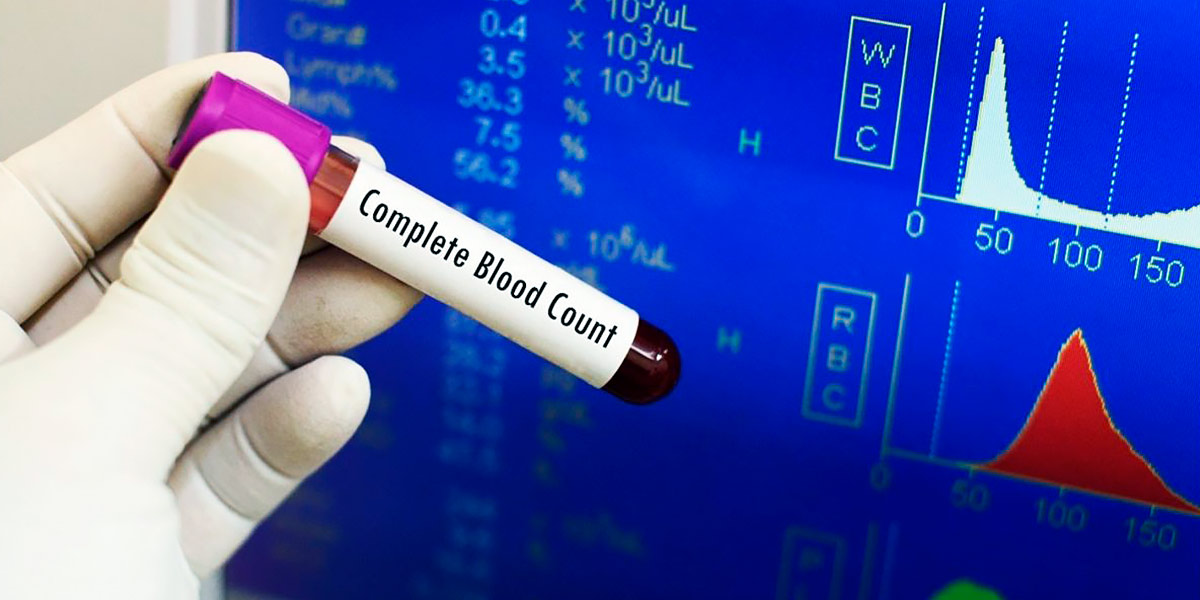 Teste sangue