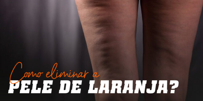 Como Evitar a Pele de Laranja? Como Evitar a Pele de Laranja?