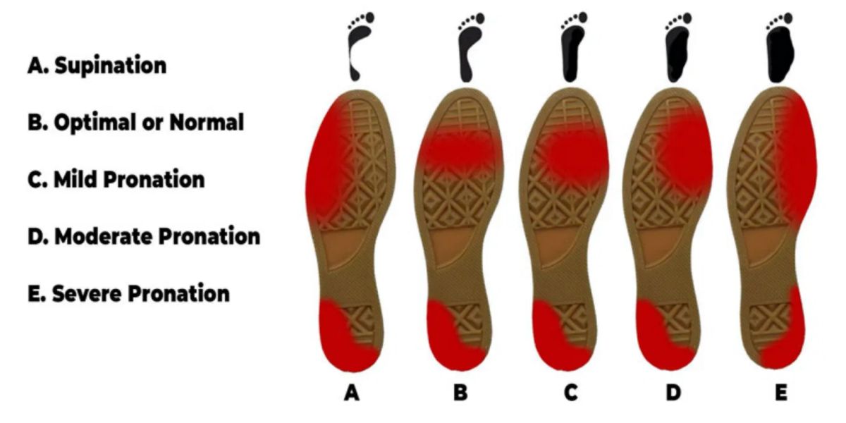 Como saber se sou pronador ou supinador