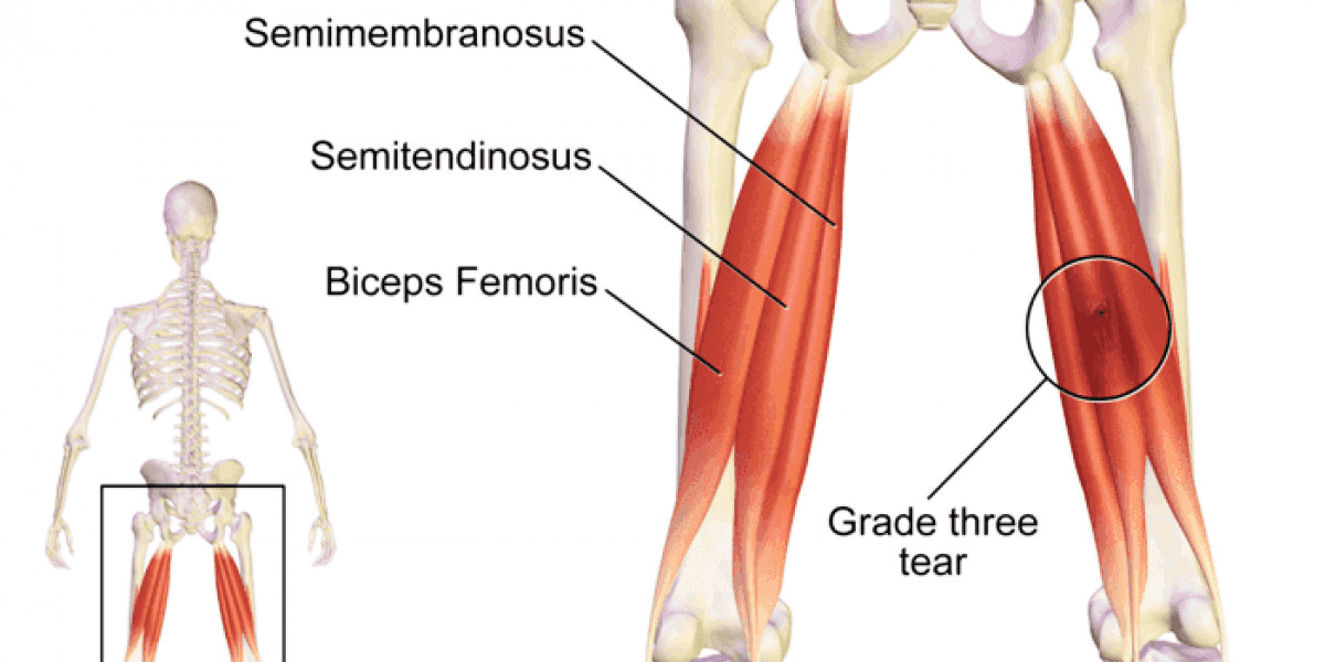 Os três músculos que constituem os isquiotibiais