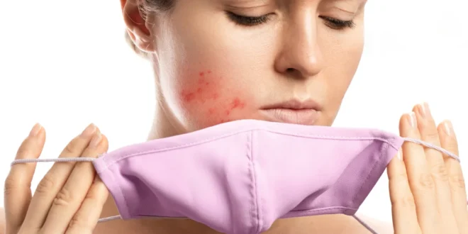 O que é a maskne e como posso tratá-la? O que é a maskne e como posso tratá-la?