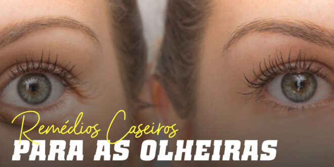 Cuidado com as Olheiras: Vamos contar-te os Melhores Remédios Caseiros