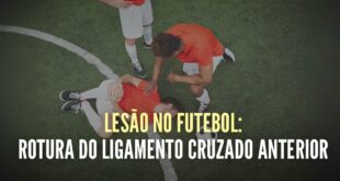 A lesão mais temida no Futebol: Ligamento Cruzado Anterior