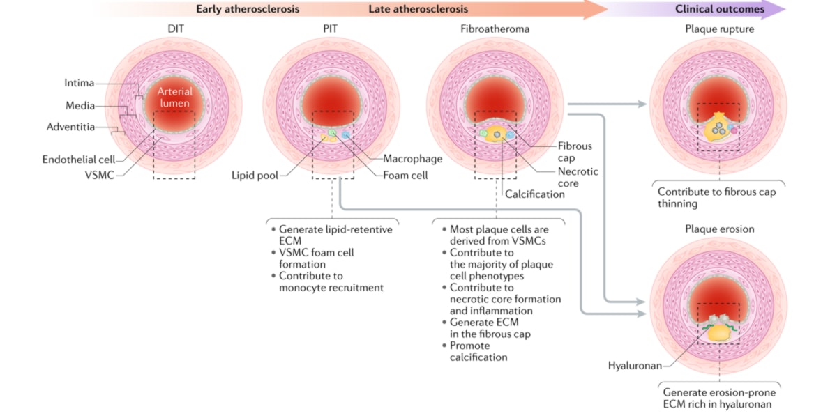 Nattokinase para o sistema cardiovascular