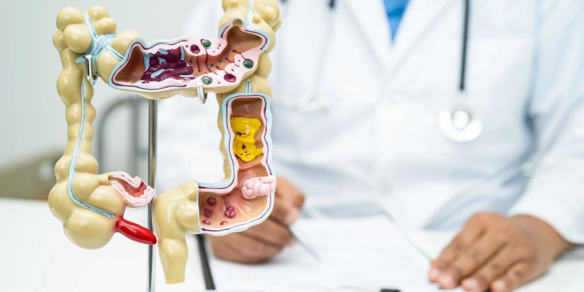 Inflamatórias intestinais