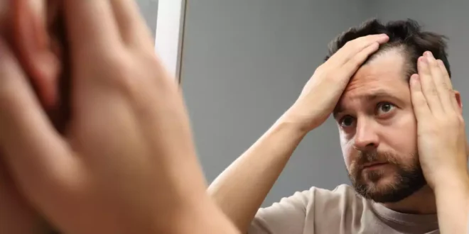 Como tratar a alopecia e evitar a queda de cabelo Como tratar a alopecia e evitar a queda de cabelo