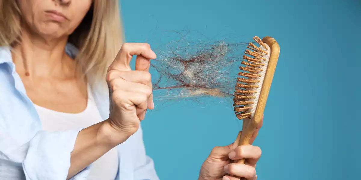 Alopecia em mulheres Alopecia em mulheres