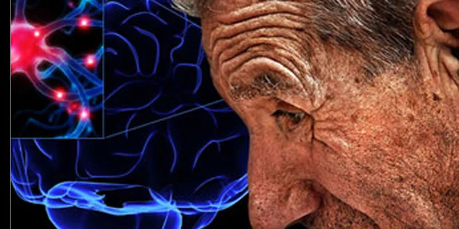 Exercício físico específico para o Parkinson