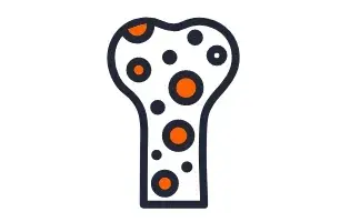 Diminuição da densidade óssea.