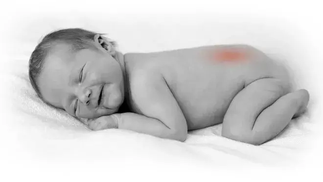 para que serve o &Aacute;cido F&oacute;lico