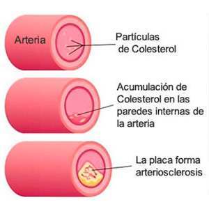 betaglucanos contra el colesterol beta-glucanos y colesterol